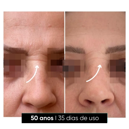 img4 mariav2